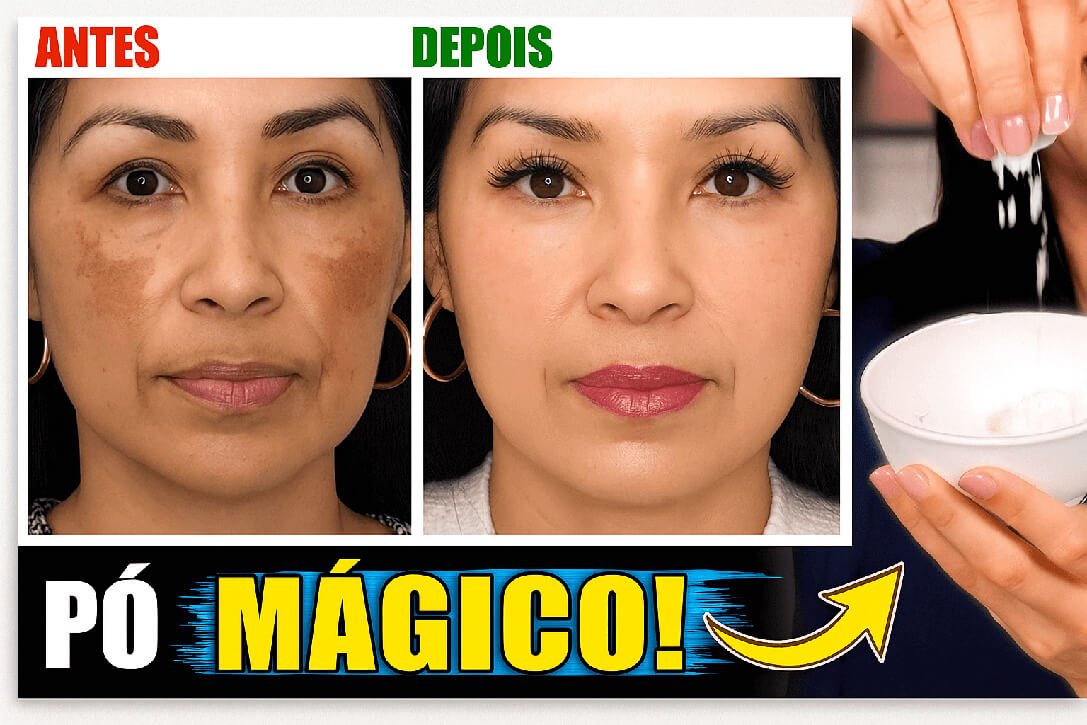 Home 1 Como Clarear Manchas de Pele Naturalmente: Receita Caseira com Farinha de Arroz